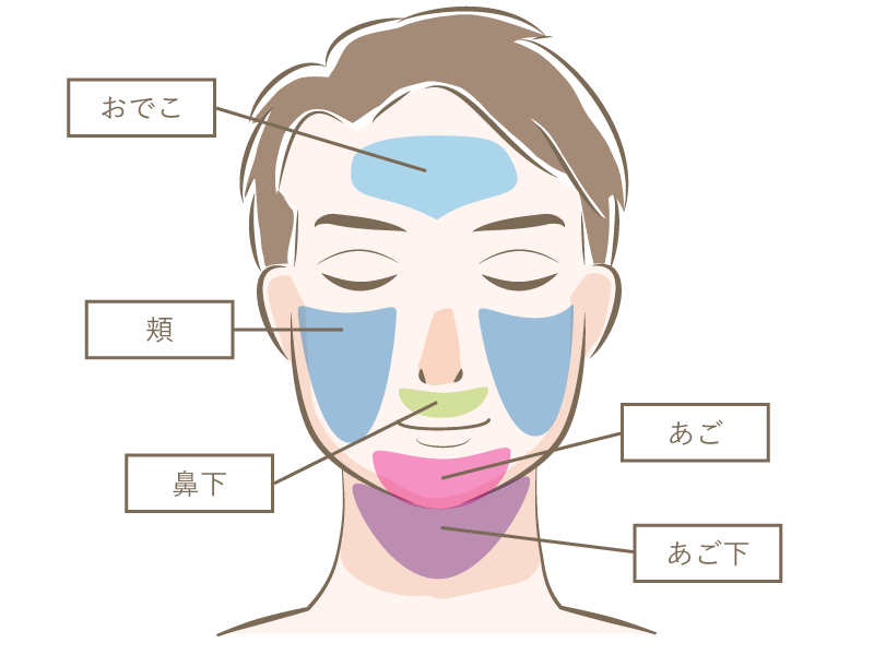 顔丸ごと脱毛