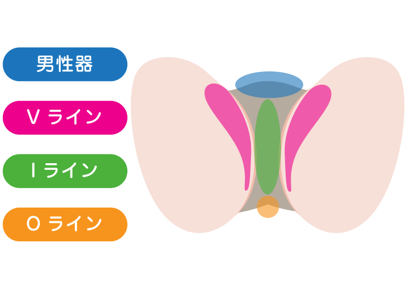 VIO丸ごと脱毛