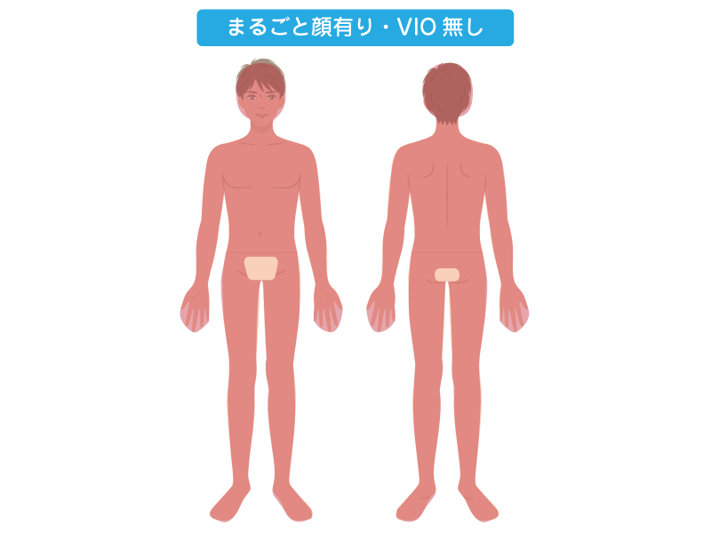 全身丸ごと脱毛シリーズ(顔有り・VIO無し)