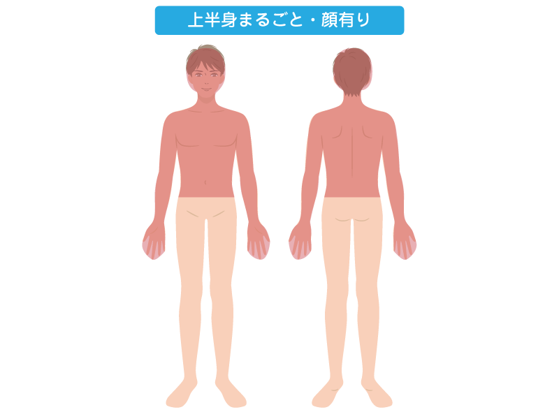 ハーフ脱毛　上半身